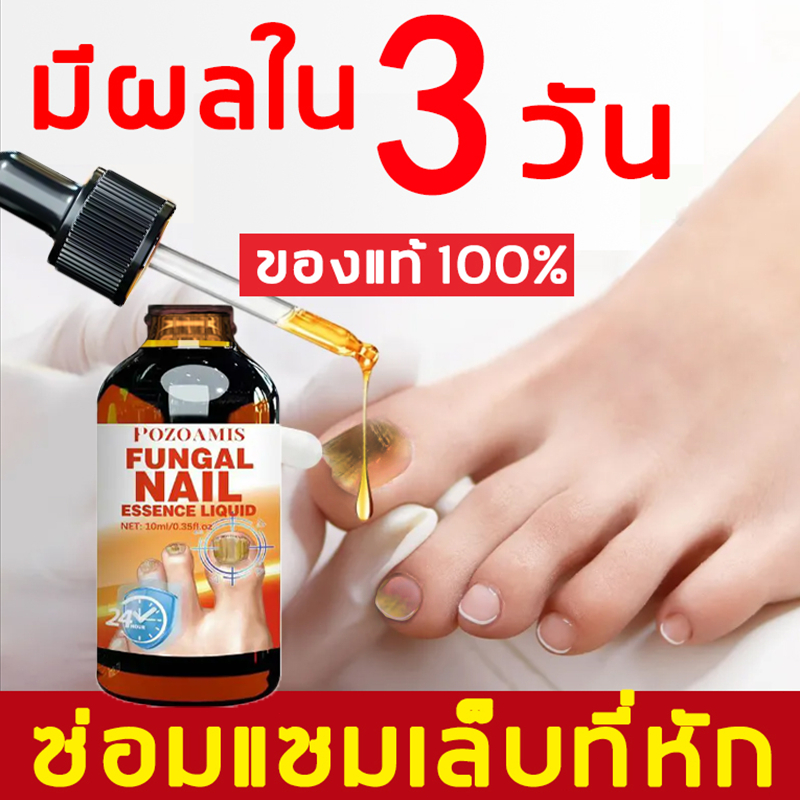 🔥เซรั่มบำรุงเล็บ🔥 ปรับปรุงเล็บสีเหลืองและเสียหาย เชื้อราเล็บมือ,แก้เชื้อราที่เล็บ,บำรุงเล็บ🎇