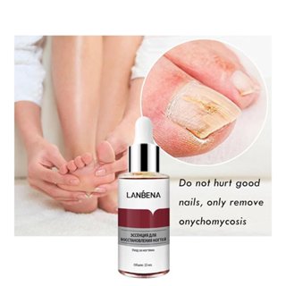 LANBENA Nail Essence ยาทาเล็บป้องกันเชื้อรา เซรั่มซ่อมแซมเล็…