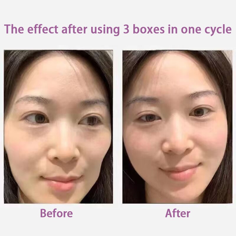 10 ชิ้น PPP HUNMUI 5 ชิ้น มาสก์นาโซลาเบียล พับ มาสก์จางลง สติกเกอร์หน้าผาก V มาสก์หน้า / มาสก์ตา คอ มาสก์ มอยส์เจอร์ไรเซอร์ - รูปที่ 2