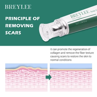 Breylee ลบรอยแผลเป็น Acne Scar Repair Removal Cream FDA