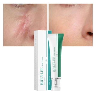Breylee ลบรอยแผลเป็น Acne Scar Repair Removal Cream FDA