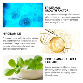 Breylee ลบรอยแผลเป็น Acne Scar Repair Removal Cream FDA