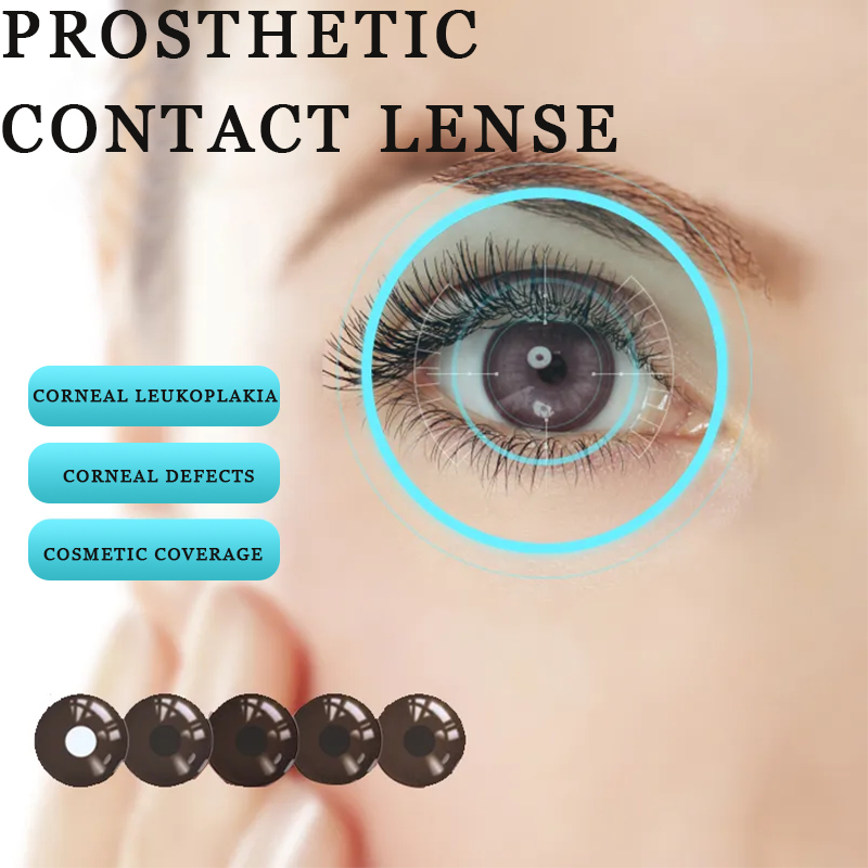 MILL CREEK คอนแทคเลนส์เทียม 14.0 มม.2 ชิ้นใช้รายปี F1/F2/F3 Natrual