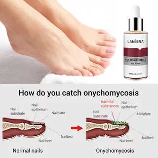 LANBENA Nail Essence ยาทาเล็บป้องกันเชื้อรา เซรั่มซ่อมแซมเล็บ 15ml