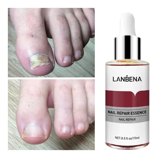 LANBENA Nail Essence ยาทาเล็บป้องกันเชื้อรา เซรั่มซ่อมแซมเล็บ 15ml
