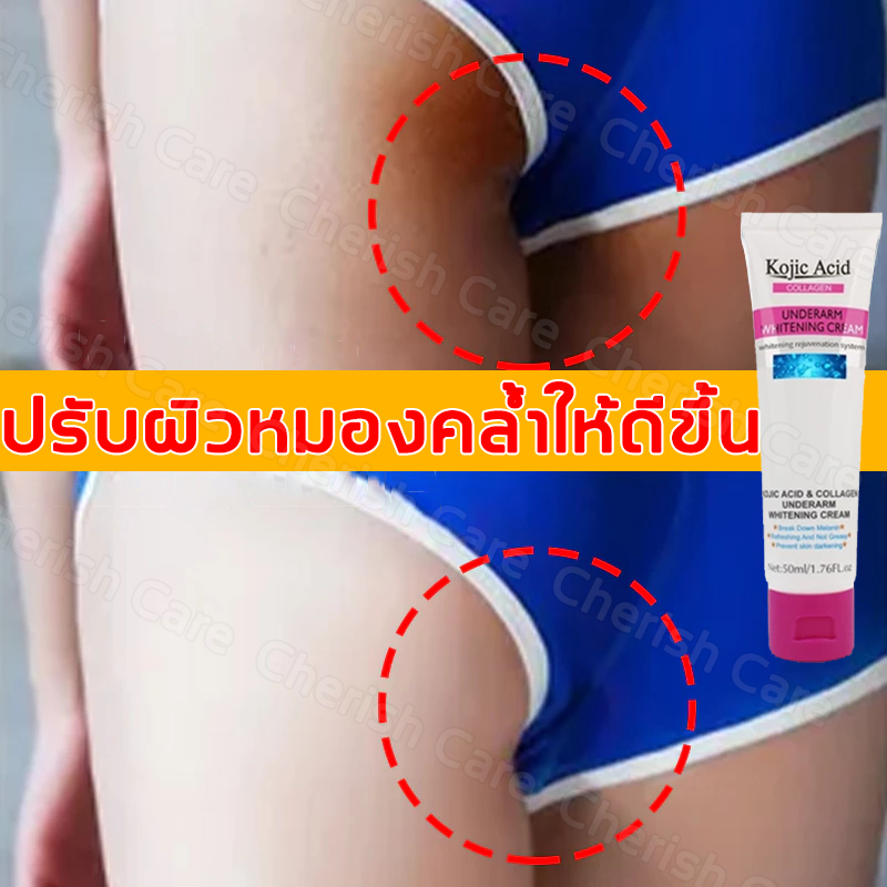 💓จัดส่งด่วน💓Kojic Acid ครีมขาวจุดซ่อนเร้น ครีมไวท์เทนนิ่งรักแร้ ช่วยลดเมลานิน เหมาะสำหรับรักแร้ ข้อศ