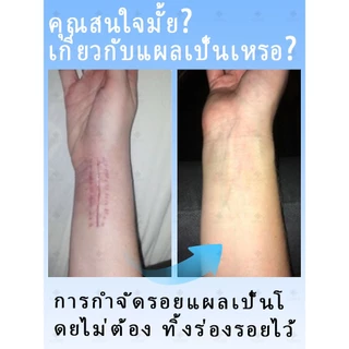 [กำจัดรอยแผลเป็น] ครีมลบรอยแผลเป็นอย่างรวดเร็ว เหมาะสำหรับการซ่อมแซมผิวจากรอยแผลเป็นจากการเสียดสี จากไฟไหม้ หลังผ่าตัด แตกลาย ฯลฯ