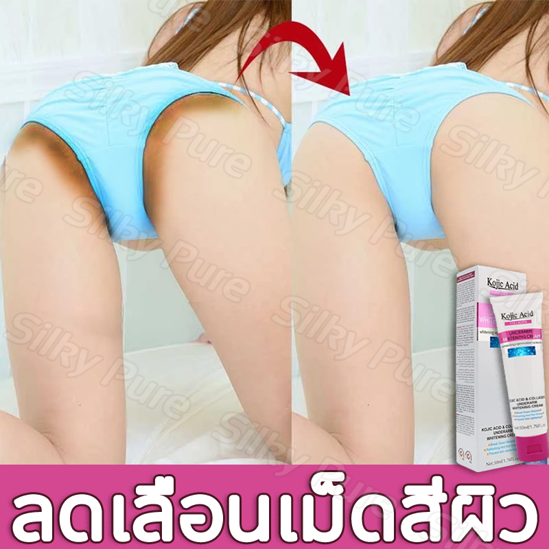 💕ของแท้💕Kojic Acid ครีมรักแร้ขาว ช่วยลดเลือนเม็ดสีผิวบริเวณจุดซ่อนเร้น ปานนม ขาหนีบ ข้อศอก รักแร้ ดั