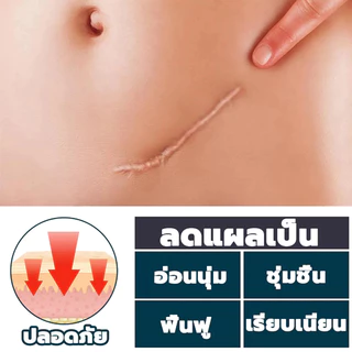 เจลซ่อมแซมรอยแผลเป็น เจลรอยแผลเป็น ครีมทาแผลเป็น ครีม สําหรับรอย ผ่าตัด น้ําร้อนลวก