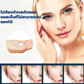 เจลซ่อมแซมรอยแผลเป็น เจลรอยแผลเป็น ครีมทาแผลเป็น ครีม สําหรับรอย ผ่าตัด น้ําร้อนลวก