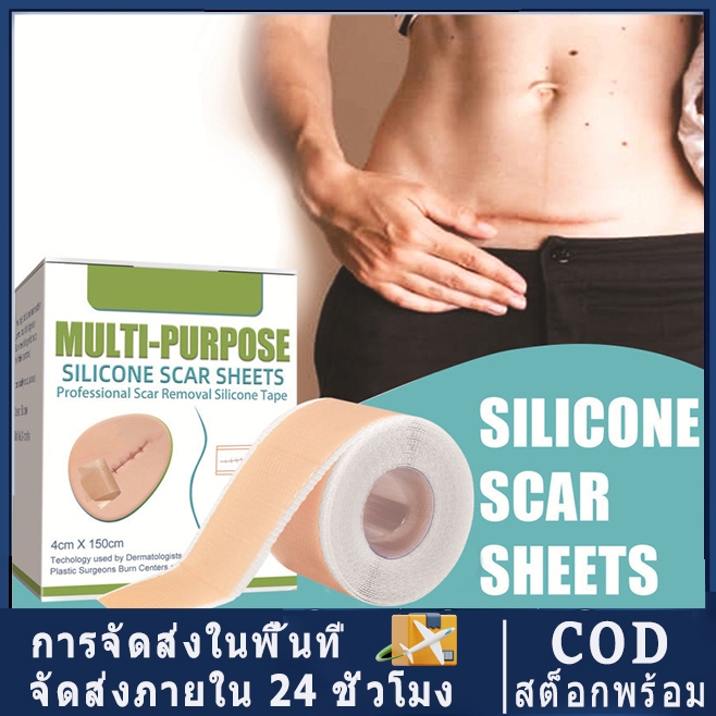 【จัดส่งในพื้นที่ COD】ซิลิโคนเจลแถบแพทช์ซิลิโคนแผลเป็นแผ่นนํามาใช้ใหม่ซิลิโคนแผลเป็นกําจัดแพทช์ลบ ทูมา เผาแผลเป็นแผ่นซ่อมแซมผิวกําจัดรอยแผลเป็นแพทช์บําบัด