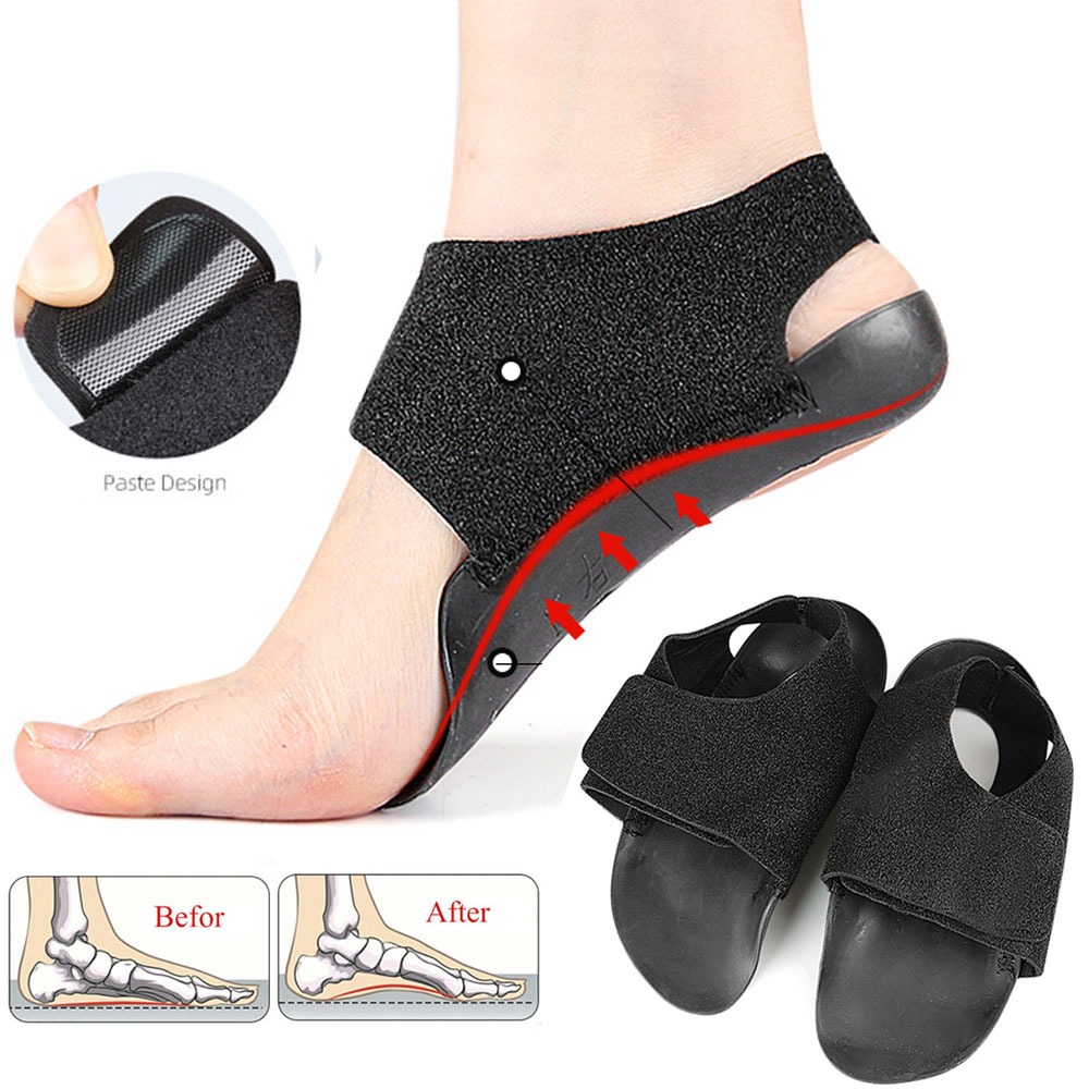 สวมใส่ศัลยกรรมกระดูก Insoles XO-Legs Orthotics Flat Foot Health Sole Pad สําหรับรองเท้าใส่ Arch Support Pad Feet Care
