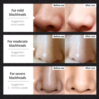 LANBENA Blackhead Remover Mask 50g แผ่นมาส์กกำจัดสิวเสี้ยน ลดสิวเสี้ยน ทำความสะอาดรูขุมขน มาส์กหน้า