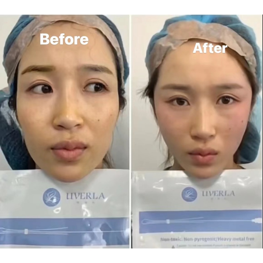 SKY-3 pdo Volt Lamp 9w 300 0K1.6x60cm ไฟฉายสีทอง*20 ชิ้นต่อแพ็ค