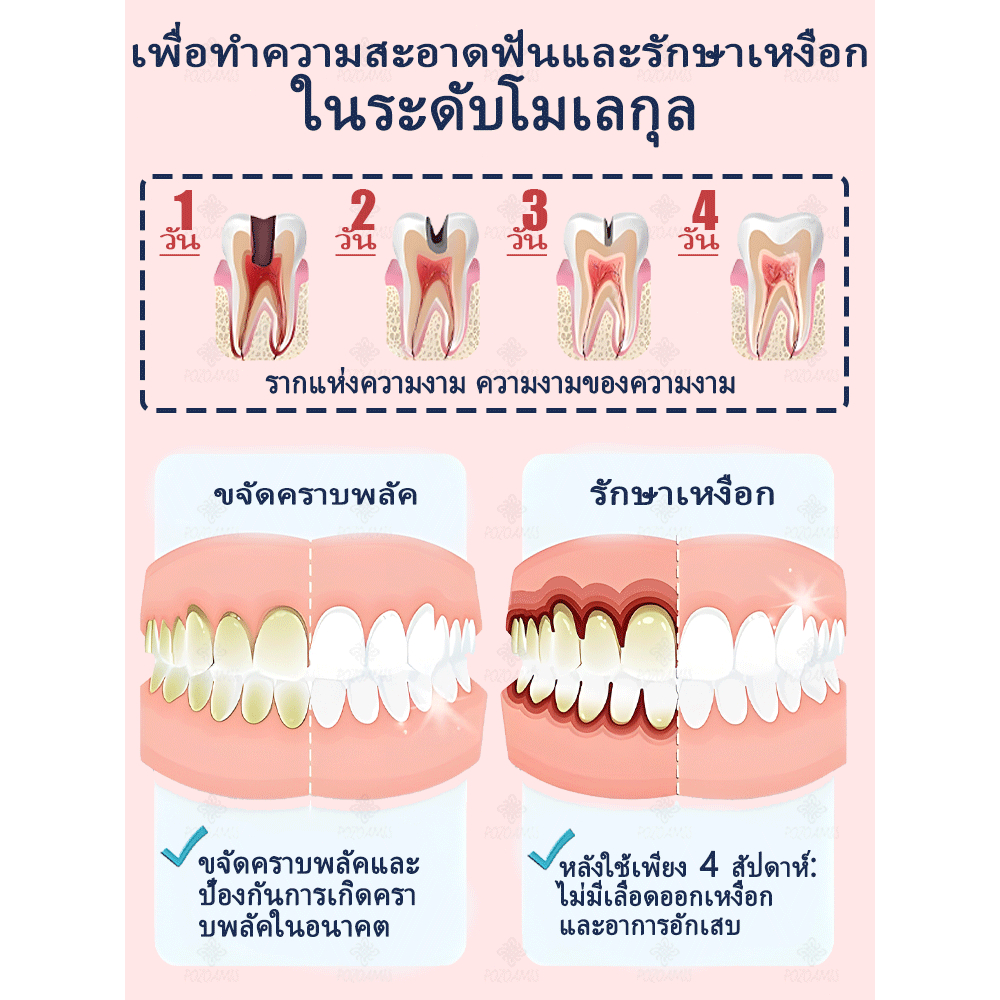 ยาสีฟันฟื้นฟูฟลูออไรด์, ป้องกันฟันผุ, อุดเคลือบฟัน, ฟันไม่แพ้ง่ายยาสีฟันป้องกันฟันผุปราศจากฟลูออไรด์ซ่อมแซมโพรงอย่างรวดเร็วและป้องกันสุขภาพ - รูปที่ 3