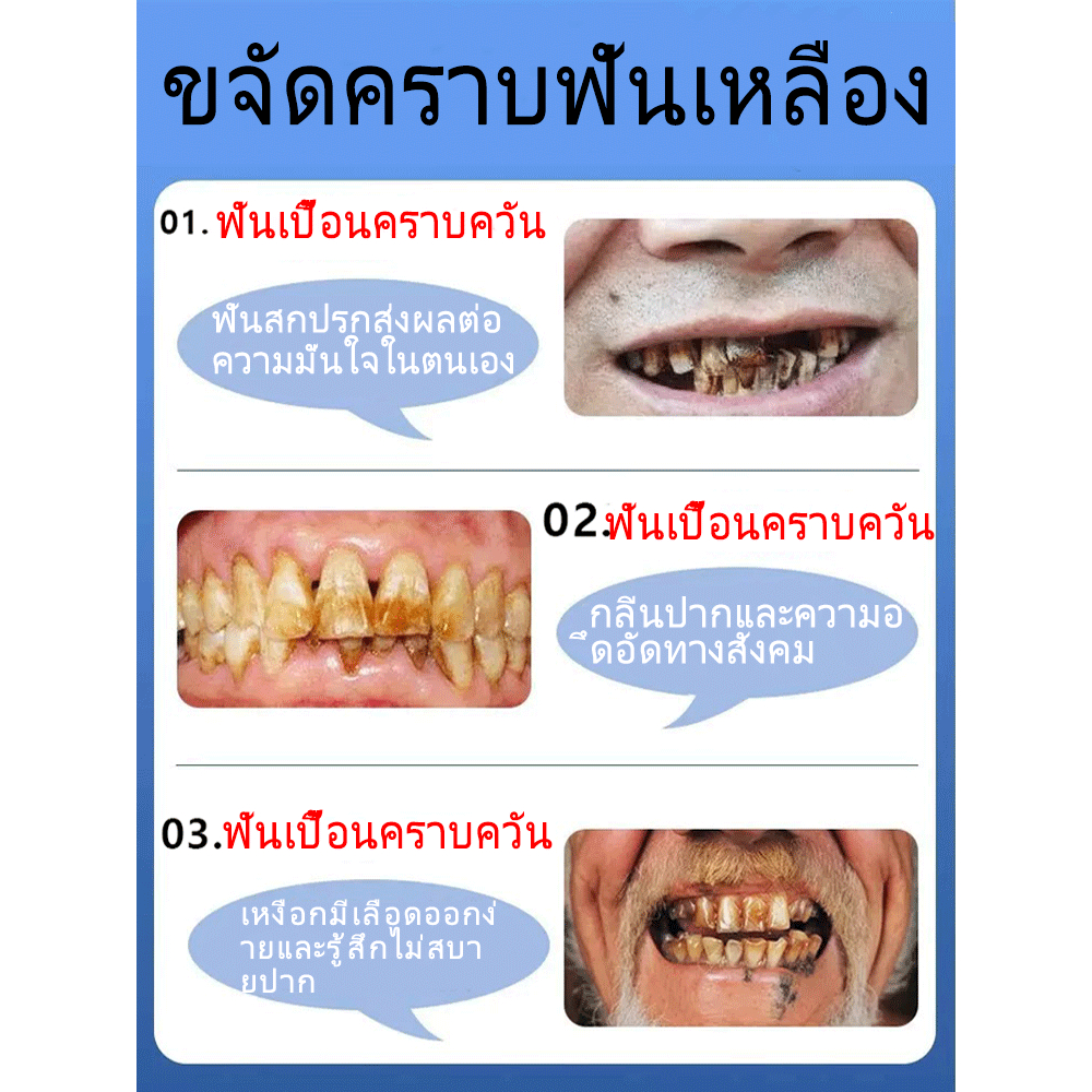 ยาสีฟันฟื้นฟูฟลูออไรด์, ป้องกันฟันผุ, อุดเคลือบฟัน, ฟันไม่แพ้ง่ายยาสีฟันป้องกันฟันผุปราศจากฟลูออไรด์ซ่อมแซมโพรงอย่างรวดเร็วและป้องกันสุขภาพ - รูปที่ 4