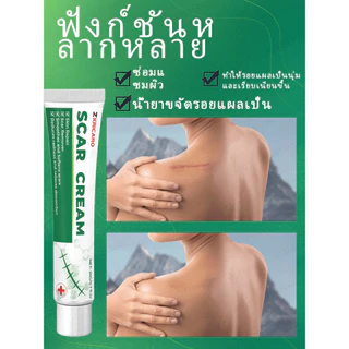 พิสูจน์แล้วว่ารักษารอยแผลเป็นใน 7 วัน ขจัดรอยแผลเป็นทุกประเภท หยุดรอยแผลเป็นจากการผ่าตัด ออกแบบมาเพื่อขจัด บอกลาจากสิว จางลงอย่างรวดเร็ว