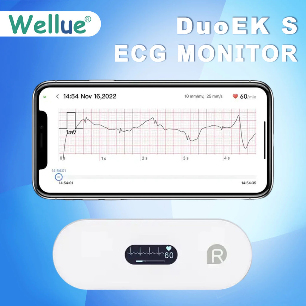 Wellue DuoEK S โฮลเตอร์ Ecg การตรวจสอบหัวใจไฟฟ้า อัตราหัวใจ Ecg จอภาพแบบพกพา Ekg สำหรับ iOS ส่วนตัว เครื่องบันทึก Ecg Holter