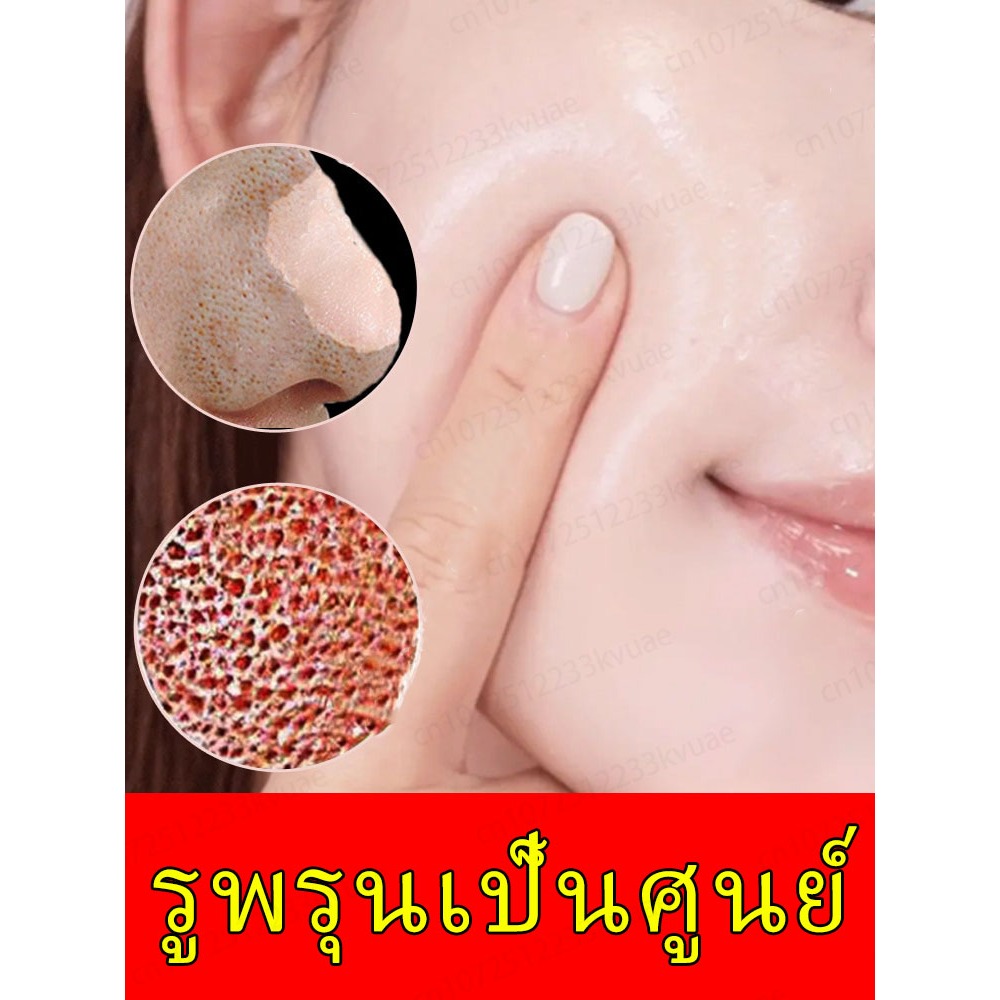 รูขุมขน ​​Minimizing essence ควบคุมความมัน กําจัดสิวหัวดํา ลดขนาดรูขุมขน