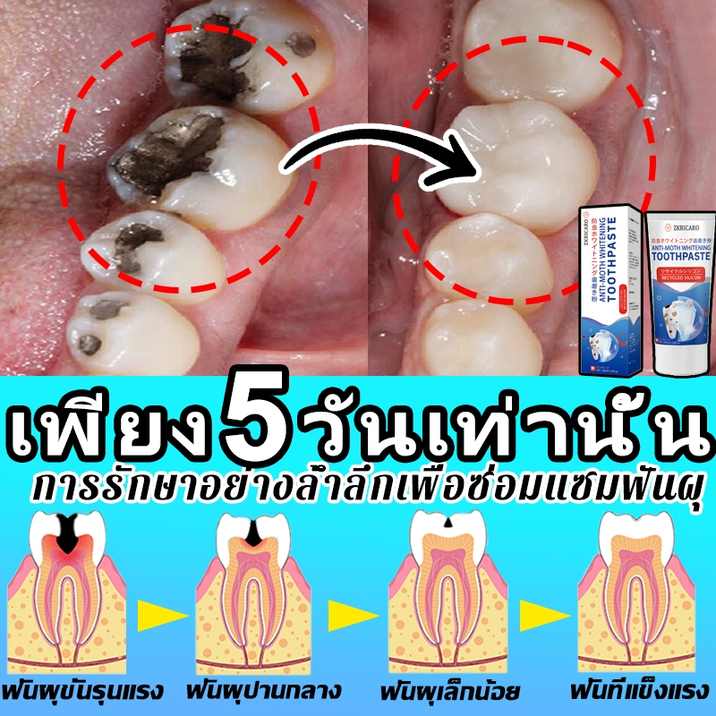 ยาสีฟันฟอกฟันขาว กําจัดคราบพลัค ป้องกันฟันผุ ซ่อมแซมเคลือบฟัน ลมหายใจสดชื่น