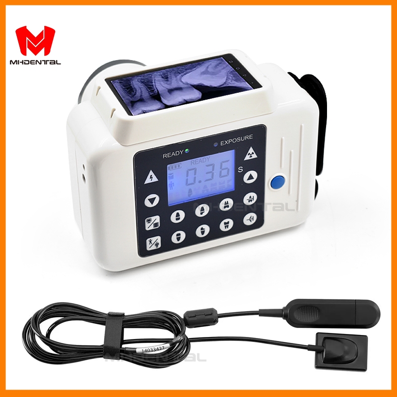 ระบบถ่ายภาพทันตกรรม เครื่อง X-Ray ดิจิตอลแบบพกพาพร้อมเซ็นเซอร์ทันตกรรม Rvg แบบพกพาจอแสดงผลในตัวอุปกรณ์ Xray มือถือ