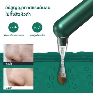 INSMART เครื่องดูดสิวเสี้ยน พร้อมหัววัด แสดงผล LCD ระดับพลังดูด 5 ระดับ เครื่องทําความสะอาดรูขุมขน