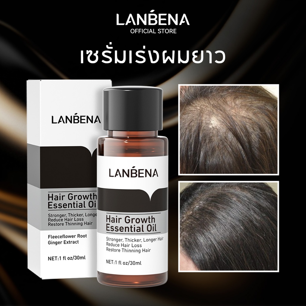 LANBENA เซรั่มปลูกผมเร่งผมยาวเร็ว ลดผมร่วง ผมหนาแน่น เซรั่มผมยาวธรรมชาติ น้ำมันหอมระเหยสูตรเข้มข้น ผลิตภัณฑ์ดูแลเส้นผม ปลูกผมชาย 20มล Hair Growth Serum
