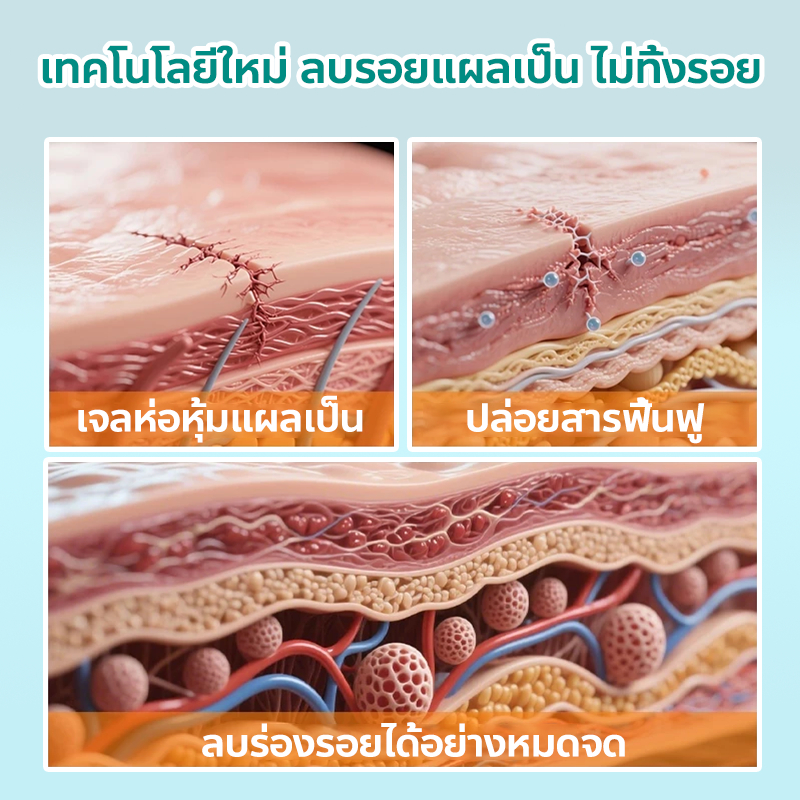 ✨ของแท้✨ South Moon สเปรย์ลบรอยแผลเป็น ลบรอยแผลเป็น ลดรอยแผลเป็น กำจัดรอยแผลเป็น รอยดำจากแผล รอยยุงกัด รอยแผลจากการผ่าตัด รอยแตกลาย รอยสิว ไม่มีการระคายเคืองผิว ลดรอยแผลเป็น ฟื้นฟูผิว คืนความเรียบเนียนให้ผิว 20g ราคา ถูกที่สุด ดีลบีเคเค แกลเลอรีภาพที่ 5