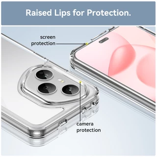 UFLAXE COMO - เคส Honor 400 / Honor 400 Pro / Honor 400 Lite - เคสแข็งใสกันเหลืองกันกระแทก เคสโทรศัพท์บางเฉียบป้องกันรอยนิ้วมือ
