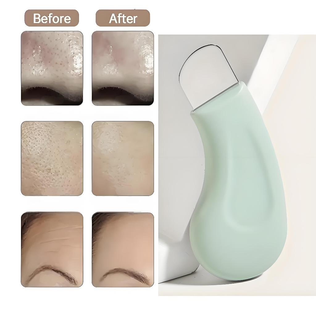 พลั่วกําจัดสิวหัวดําซิลิโคนจับ Dead Skin สิวซิลิโคนพลั่ว Scraper ผมบนใบหน้า Follicle ทําความสะอาดผิวหน้า Follicle ทําความสะอาด Exfoliating Care ลบ Whiteheads จมูก