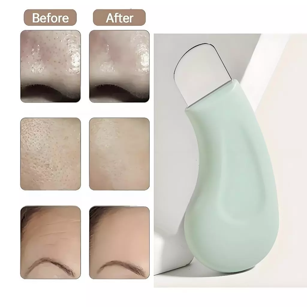 พลั่วกําจัดสิวหัวดําซิลิโคนจับ Dead Skin สิวซิลิโคนพลั่ว Scraper ผมบนใบหน้า Follicle ทําความสะอาดผิวหน้า Follicle ทําความสะอาด Exfoliating Care ลบ Whiteheads จมูก