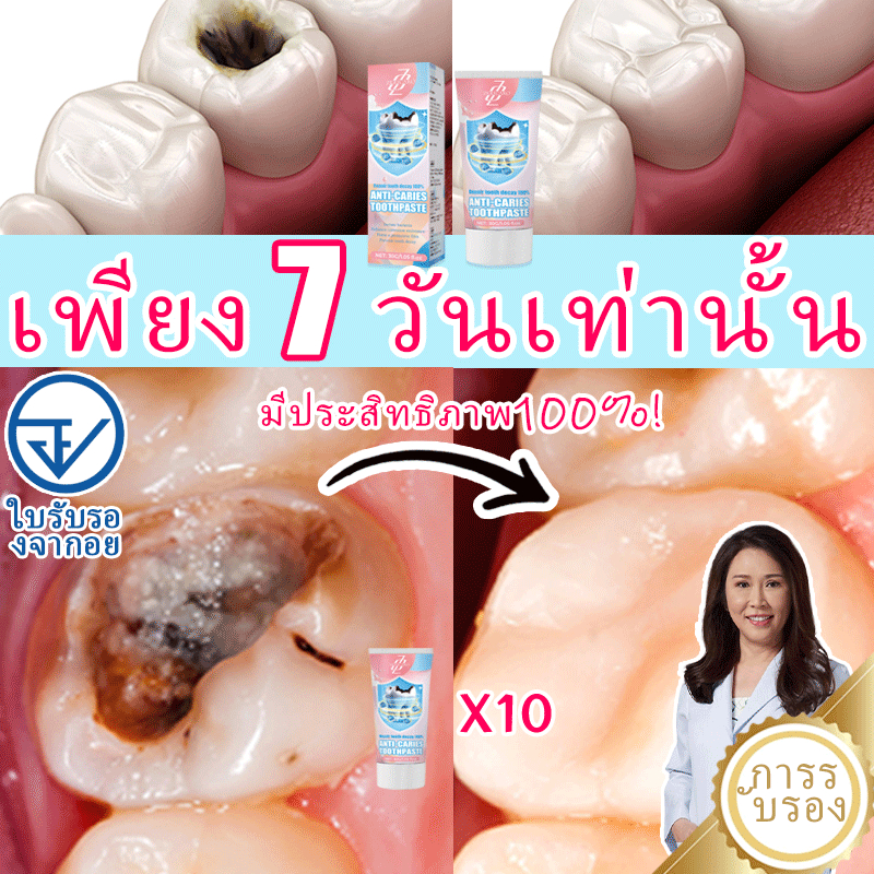 ยาสีฟันฟื้นฟูฟลูออไรด์, ป้องกันฟันผุ, อุดเคลือบฟัน, ฟันไม่แพ้ง่ายยาสีฟันป้องกันฟันผุปราศจากฟลูออไรด์ซ่อมแซมโพรงอย่างรวดเร็วและป้องกันสุขภาพ