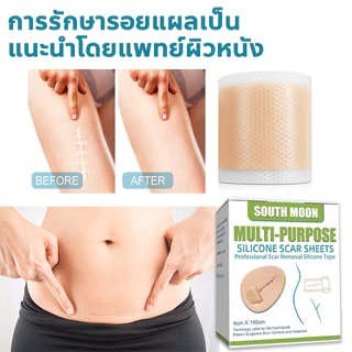 ✨ของแท้✨ แผ่นแปะลดรอยแผลเป็น South Moon กำจัดแผลเป็น กำจัดรอยยุงกัด กำจัดดำ รอยแผลเป็นจากสิว จากการผ่าตัด เห็นผลเร็ว ขนาด 4*150cm ตัดฟรี
