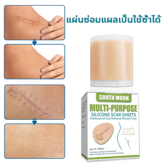 ✨ของแท้✨ แผ่นแปะลดรอยแผลเป็น South Moon กำจัดแผลเป็น กำจัดรอยยุงกัด กำจัดดำ รอยแผลเป็นจากสิว จากการผ่าตัด เห็นผลเร็ว ขนาด 4*150cm ตัดฟรี