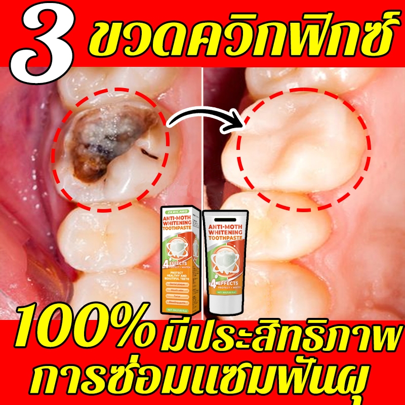 【ซ่อมแซมฟันผุอย่างรวดเร็ว】ป้องกันฟันผุ, ฟันขาว, ยาสีฟันไวท์เทนนิ่งและป้องกันฟันผุ, รักษาฟันผุ, เหงือกบวม, การสูญเสียฟัน, และช่วยให้ฟันแข็งแรง