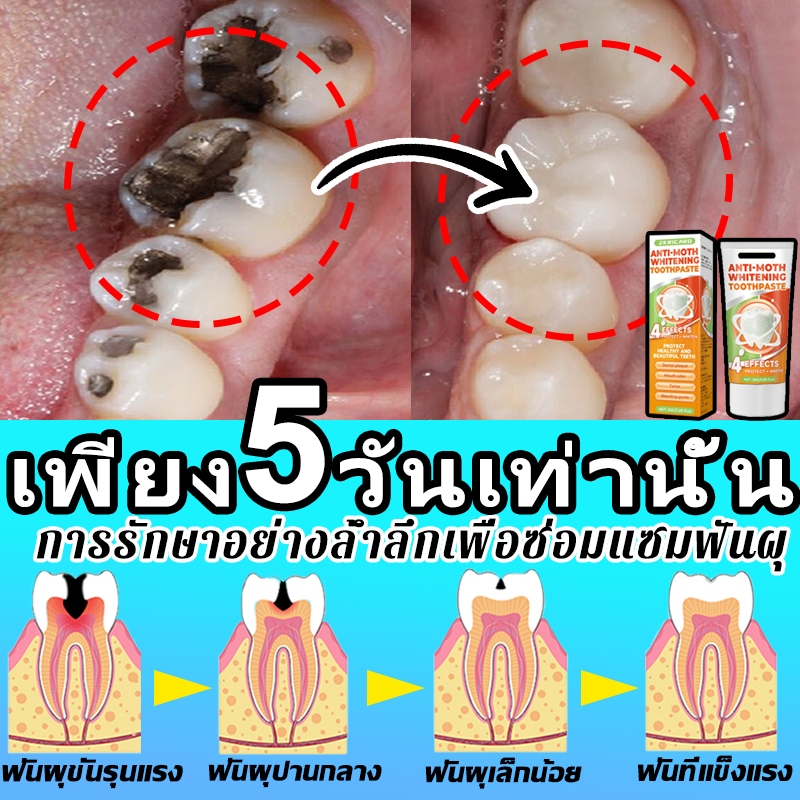 🚀พร้อมส่ง🚀ซ่อมแซมโพรง ลดโพรง ยาสีฟันไวท์เทนนิ่งและป้องกันฟันผุ ขจัดคราบจุลินทรีย์และหินปูน ฟันขาว ลดกลิ่นปาก ยาสีฟันพกพา ยาสีฟันต้านจุ