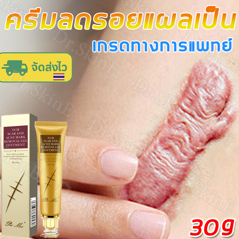 ⚡จัดส่งด่วน⚡ ครีมลบรอยแผลเป็น ครีมจางรอยแผลเป็น เห็นผลจริง ลบรอยแผลเป็นเก่า แผลผ่าคลอด แผลเป็นนูน รอยสิว รอยขีดข่วน แผลไฟไหม้ น้ำร้อนลวก ฟื้นฟูผิว ครีมลดรอยแผลเป็น 30g