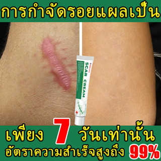 พิสูจน์แล้วว่ารักษารอยแผลเป็นใน 7 วัน ขจัดรอยแผลเป็นทุกประเภ…