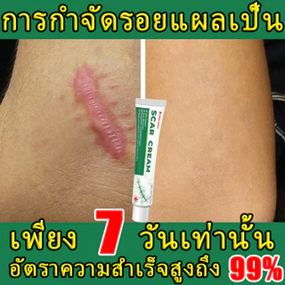 พิสูจน์แล้วว่ารักษารอยแผลเป็นใน 7 วัน ขจัดรอยแผลเป็นทุกประเภท หยุดรอยแผลเป็นจากการผ่าตัด ออกแบบมาเพื่อขจัด บอกลาจากสิว จางลงอย่างรวดเร็ว