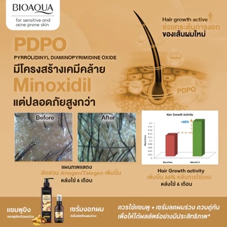 BIOAOUA เซรั่มขิงลดผมร่วง ปลูกผม เร่งผมยาว บำรุงหนังศีรษะและราก Anti-Hair Loss Serum 50ml