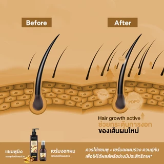BIOAOUA เซรั่มขิงลดผมร่วง ปลูกผม เร่งผมยาว บำรุงหนังศีรษะและราก Anti-Hair Loss Serum 50ml