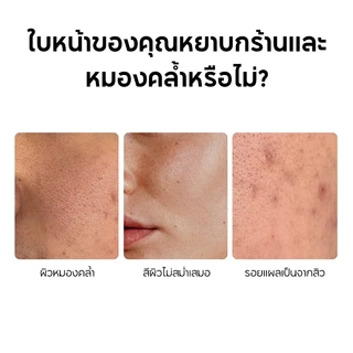 SADOER 10% Niacinamide Brightening Serum 35ml 10% ไนอาซินาไมด์ เซรั่มปรับผิวใส