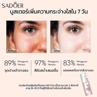 SADOER 10% Niacinamide Brightening Serum 35ml 10% ไนอาซินาไมด์ เซรั่มปรับผิวใส
