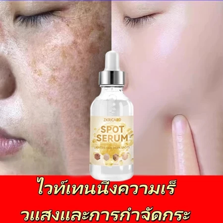【ผลิตในเกาหลี】เอสเซนส์ เอสเซนส์ลดฝ้า (เอสเซนส์ลดฝ้า ลดฝ้า กระ จุดด่างดำ ฝ้าสะสม ลดฝ้า ทำให้หน้ากระจ่างใสขึ้น) เอสเซนส์