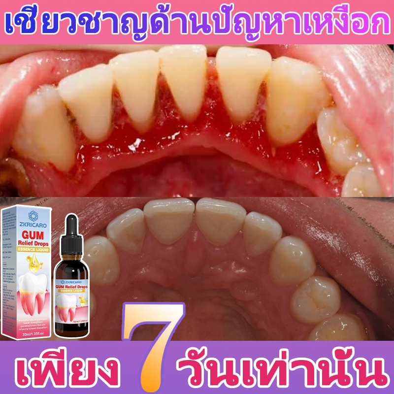 เจลซ่อมแซมเหงือกซ่อมแซมภาวะซึมเศร้าบรรเทาเหงือกบวมป้องกันเหงือกเลือดออกลดการเสียวฟันลมหายใจสดชื่นป้องกันสุขภาพฟัน