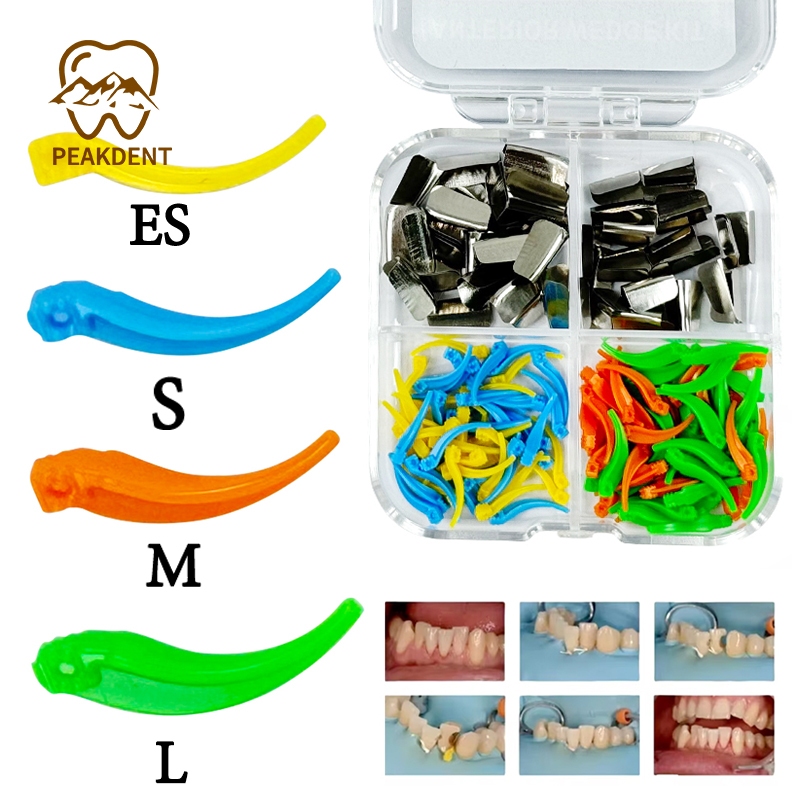 200 ชิ้น/กล่อง DENTAL ANTERIOP WEDGE ชุดสั้น 50 ชิ้น + จนถึง 50 ชิ้น MOLDING ชิ้นคลิป DENTAL FILLING