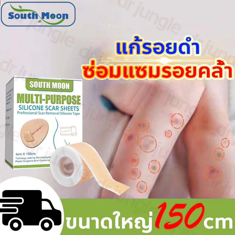 ✨ของแท้✨ แผ่นแปะลดรอยแผลเป็น South Moon กำจัดแผลเป็น กำจัดรอยยุงกัด กำจัดดำ รอยแผลเป็นจากสิว จากการผ่าตัด เห็นผลเร็ว ขนาด 4*150cm ตัดฟรี