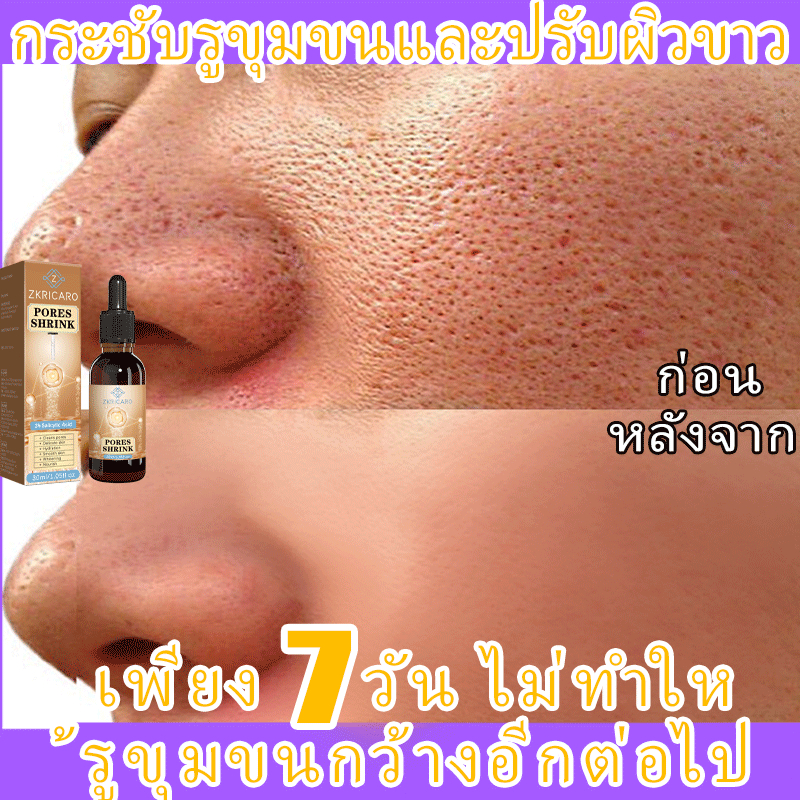 เอสเซ้นส์หดตัวรูขุมขน ขนหดตัว รูขุมหดตัว รูขุมขนหด ลบสิว ลดริ้วรอย ผิวชุ่มชื้น ซ่อมแซมควบคุมความมัน กระชับรูขุม ผิวกระชับ เหมาะสําหรับไ