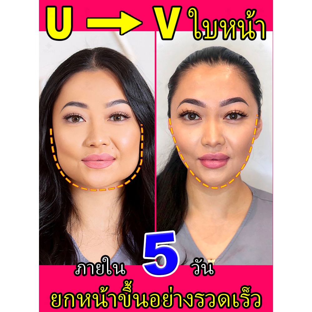 ครีมลดหน้าวีเชป ช่วยยกกระชับกล้ามเนื้อ กระชับ ลดเหนียง สร้างรูปหน้าวีไลน์กระชับ ลดเลือนริ้วรอย - ผลิตภัณฑ์