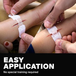 Medical Wound Closure Strips Free Latches Zip Sutures Bandages Self-adhesive Bandage Reduce Scar